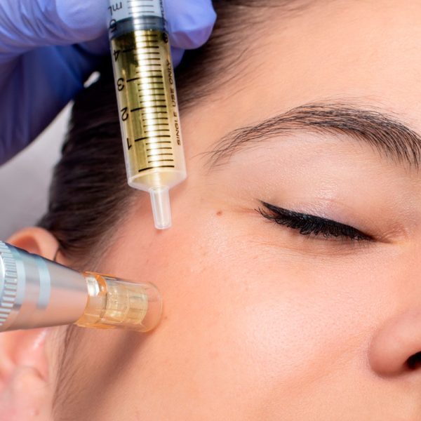 exosomas-e1726163637757